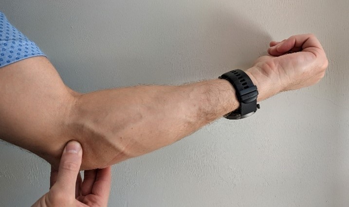 Photo Showing Physical Exam for Medial Epicondylitis