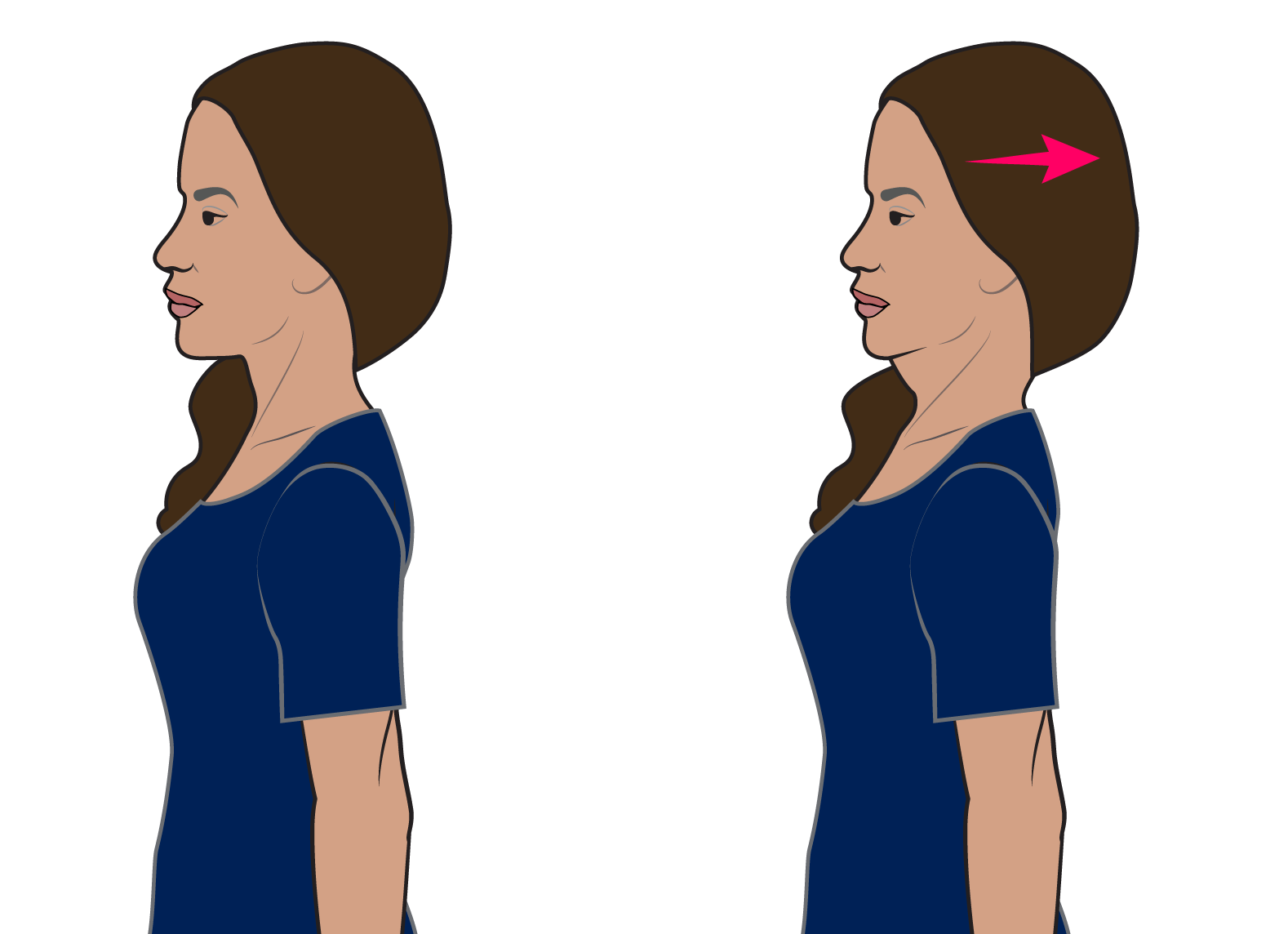 Neck Retraction