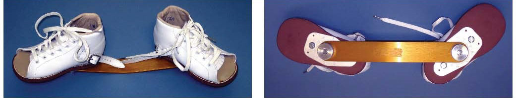 Markell abduction brace