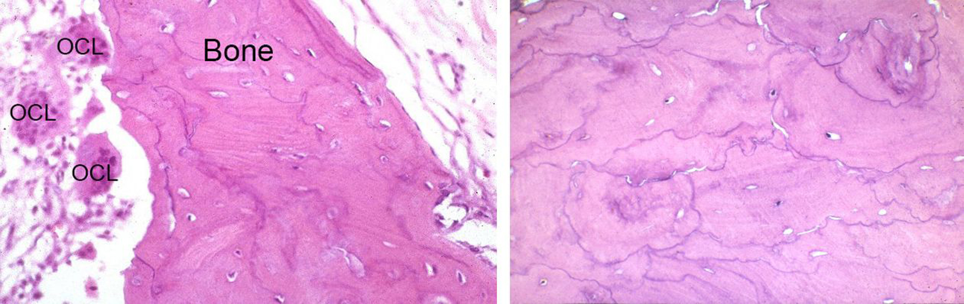 Osteoclasts