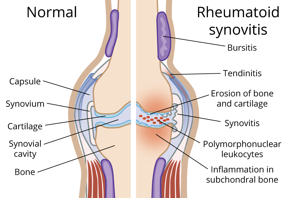 Orthopedics