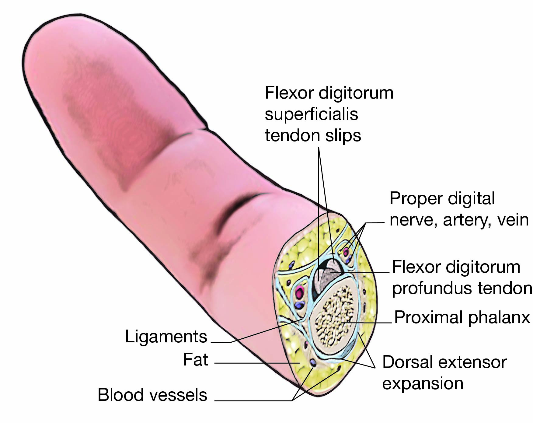 Illustration of finger for replantation