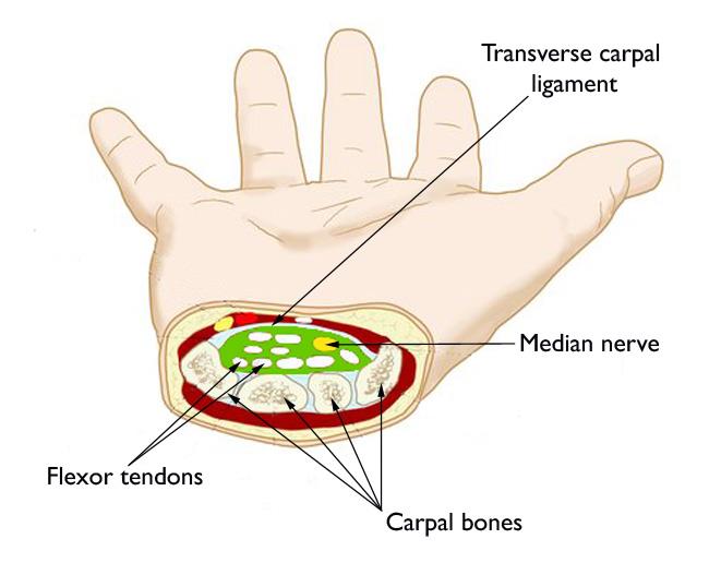 Carpal Tunnel Syndrome - Wrist - Conditions - Musculoskeletal - What We  Treat 