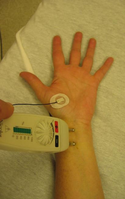 carpal tunnel nerve conduction test painful