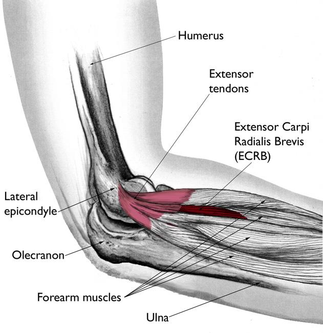 elbow tendon injury symptoms