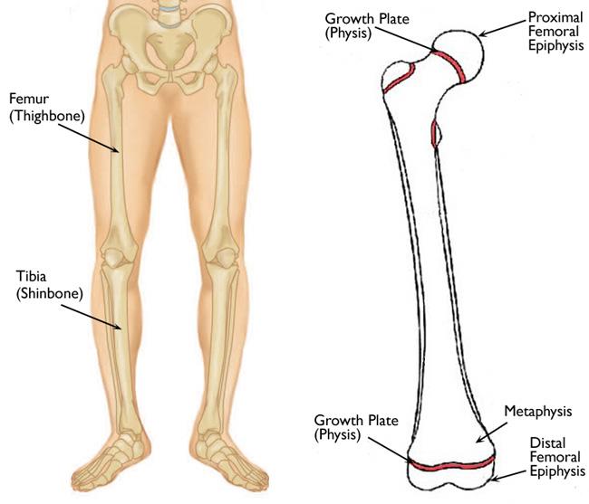 Lower Limb Length Discrepancy OrthoInfo AAOS