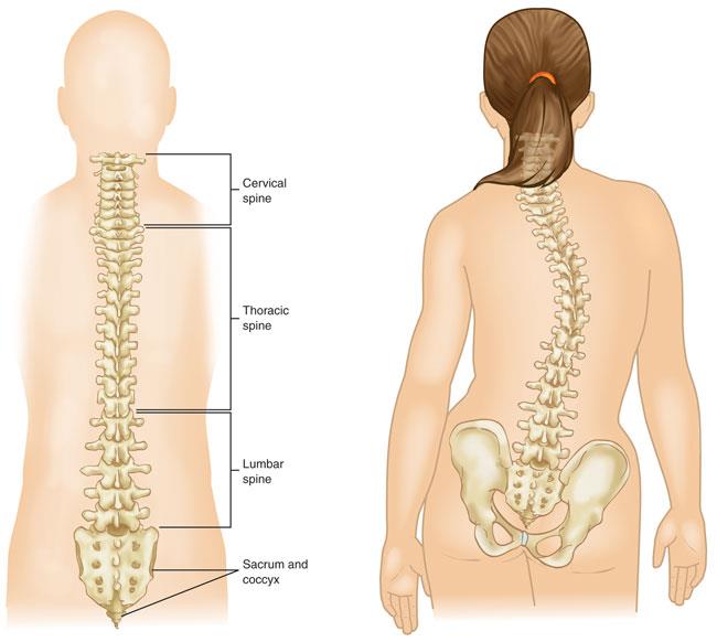 curved spine