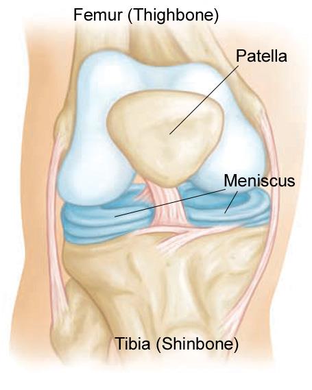 Tear in deals cartilage