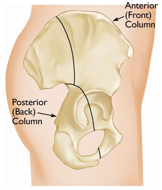 The anterior (front) and posterior (back) columns of the acetabulum. 