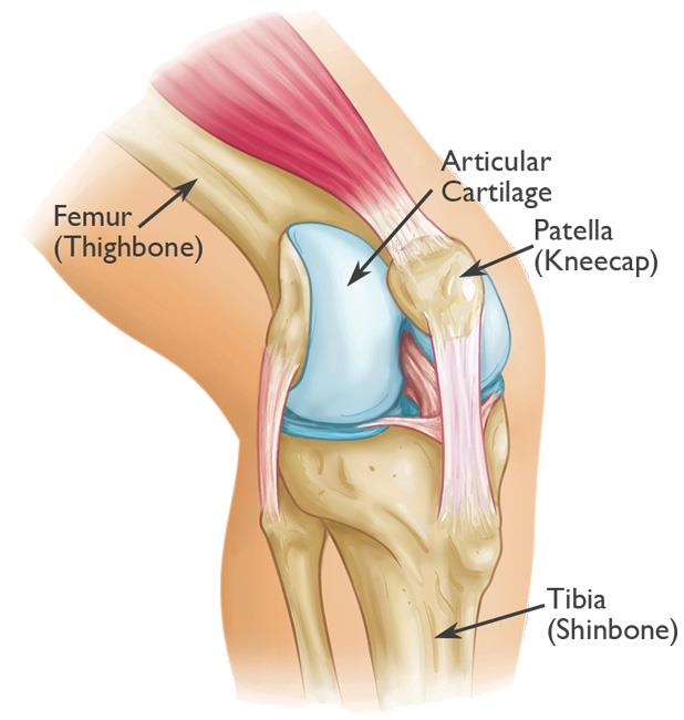 strained knee cap