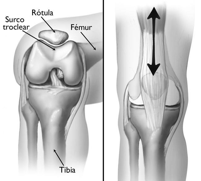 Rehabilitación y Fisioterapia - Existen lesiones del vasto externo del  muslo, las cuales pueden provocar inflamación de moderada a severa, con  incapacidad para la locomoción y función de rodilla, es necesario aplicar