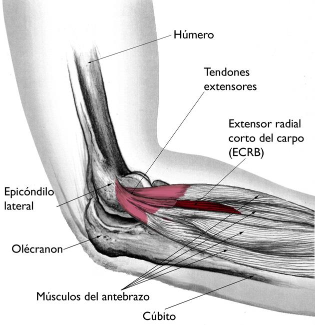 Banda Epicondilitis Lesiones Graves Codo