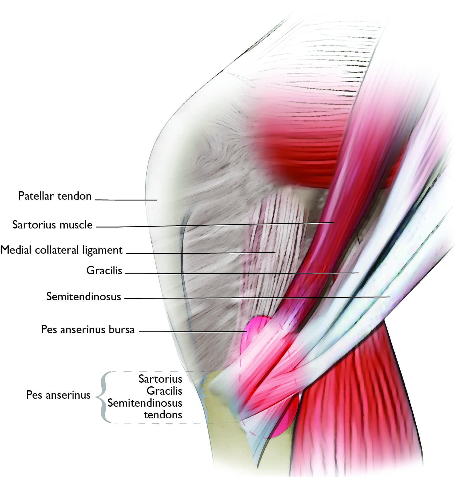 Location of pain from pes anserine bursitis