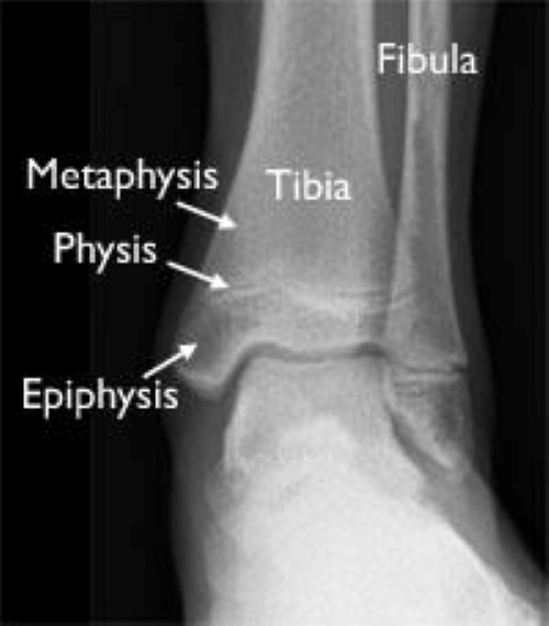 distal fibula