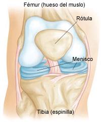 Manía Diagnosticar idiota Desgarros de los meniscus (Meniscus Tears) - OrthoInfo - AAOS