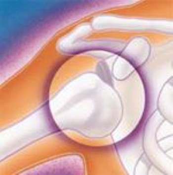 Scapula (Shoulder Blade) Fractures - OrthoInfo - AAOS