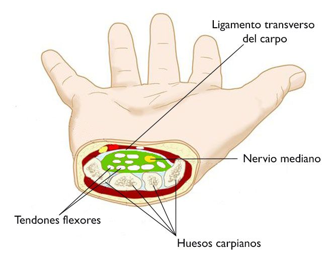 SÍNDROME DEL TÚNEL CARPIANO: ¿Qué es?, anatomía, causas y más