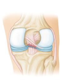 Guide  Physical Therapy Guide to Posterior Cruciate Ligament