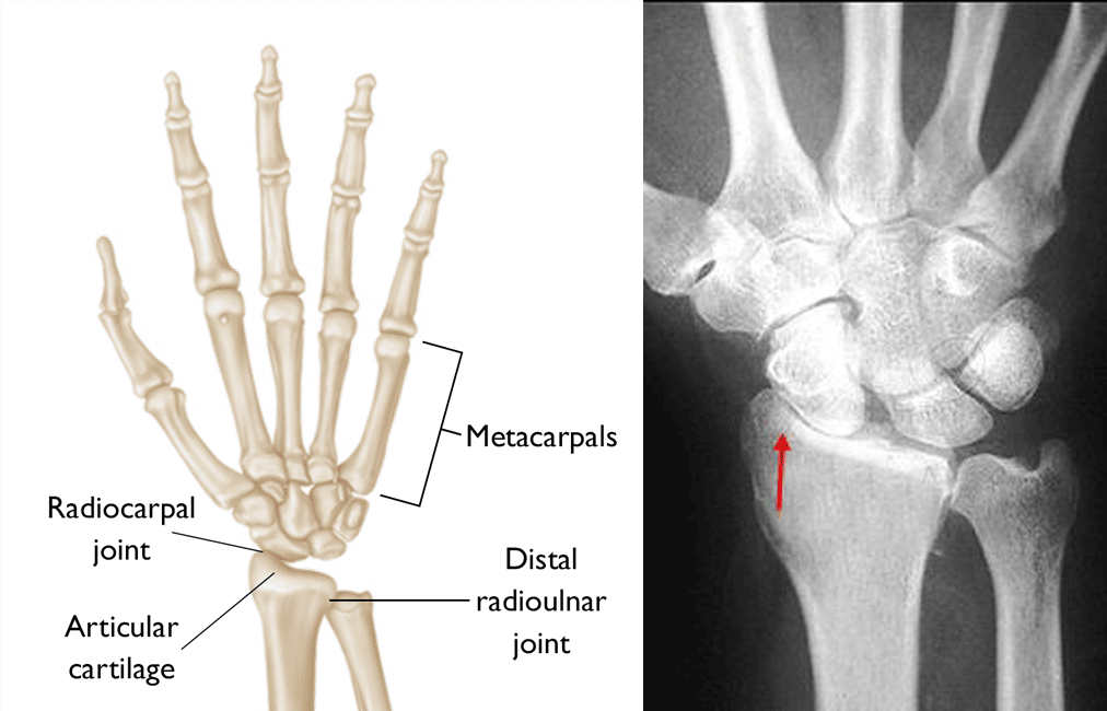 Wrist Joint Anatomy