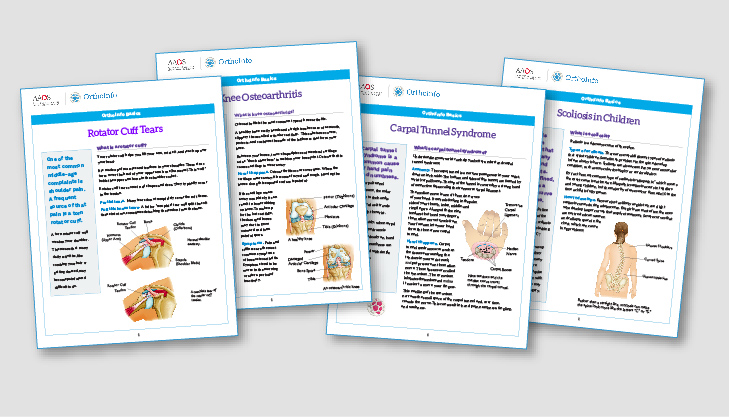 Neck Sprains and Strains - OrthoInfo - AAOS