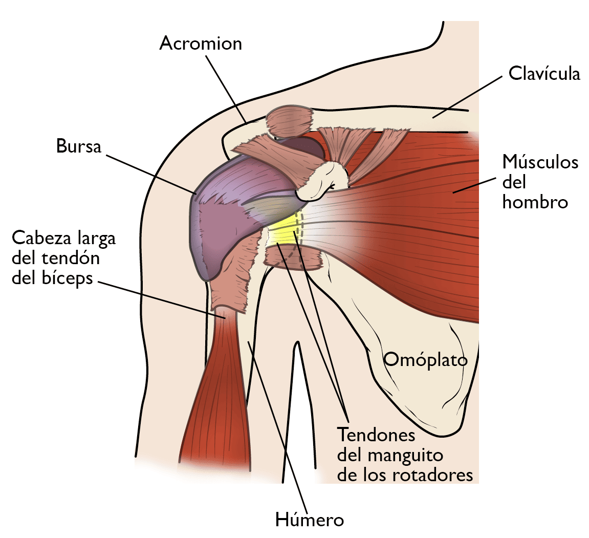 Causas del dolor de hombro y cervical - Artículos - IntraMed