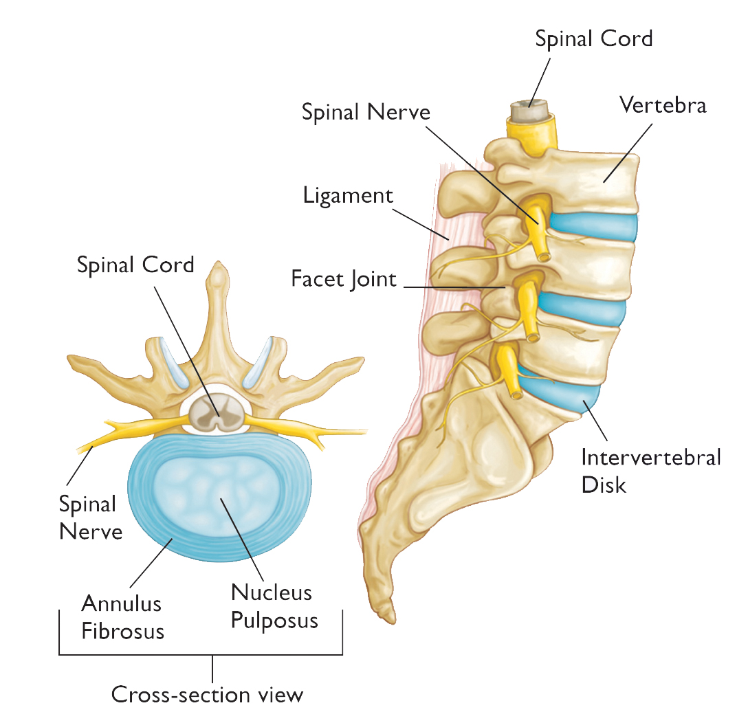 Vertebral Disc Herniation