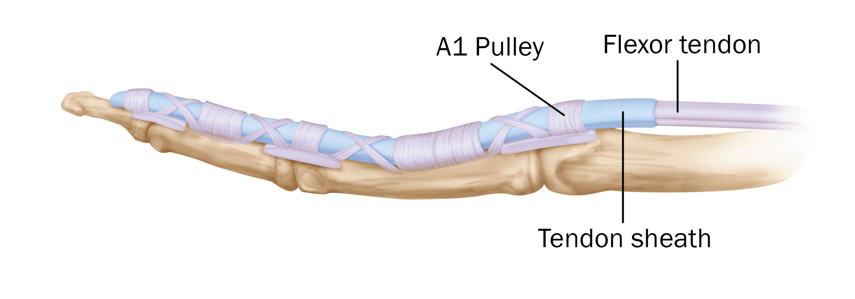 Trigger Finger Trigger Thumb Orthoinfo Aaos