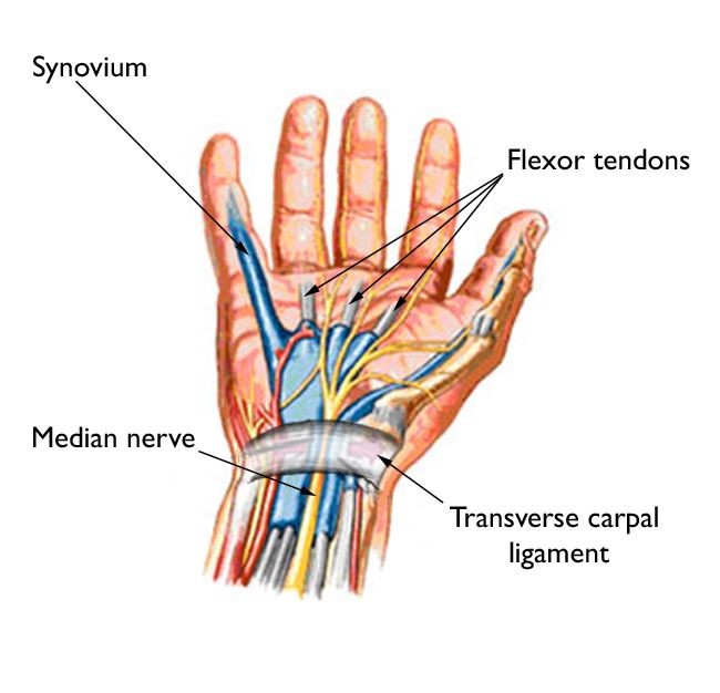 Carpal Tunnel Syndrome - Symptoms and Treatment - OrthoInfo - AAOS