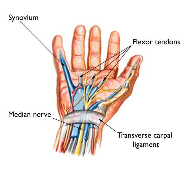 radiate ligament wrist