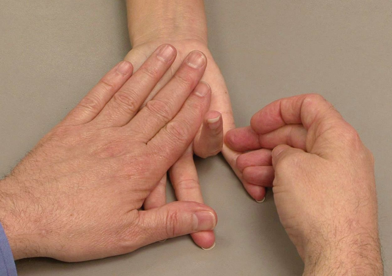 Admitir grado Borradura Dedo en gatillo (Trigger Finger) - OrthoInfo - AAOS