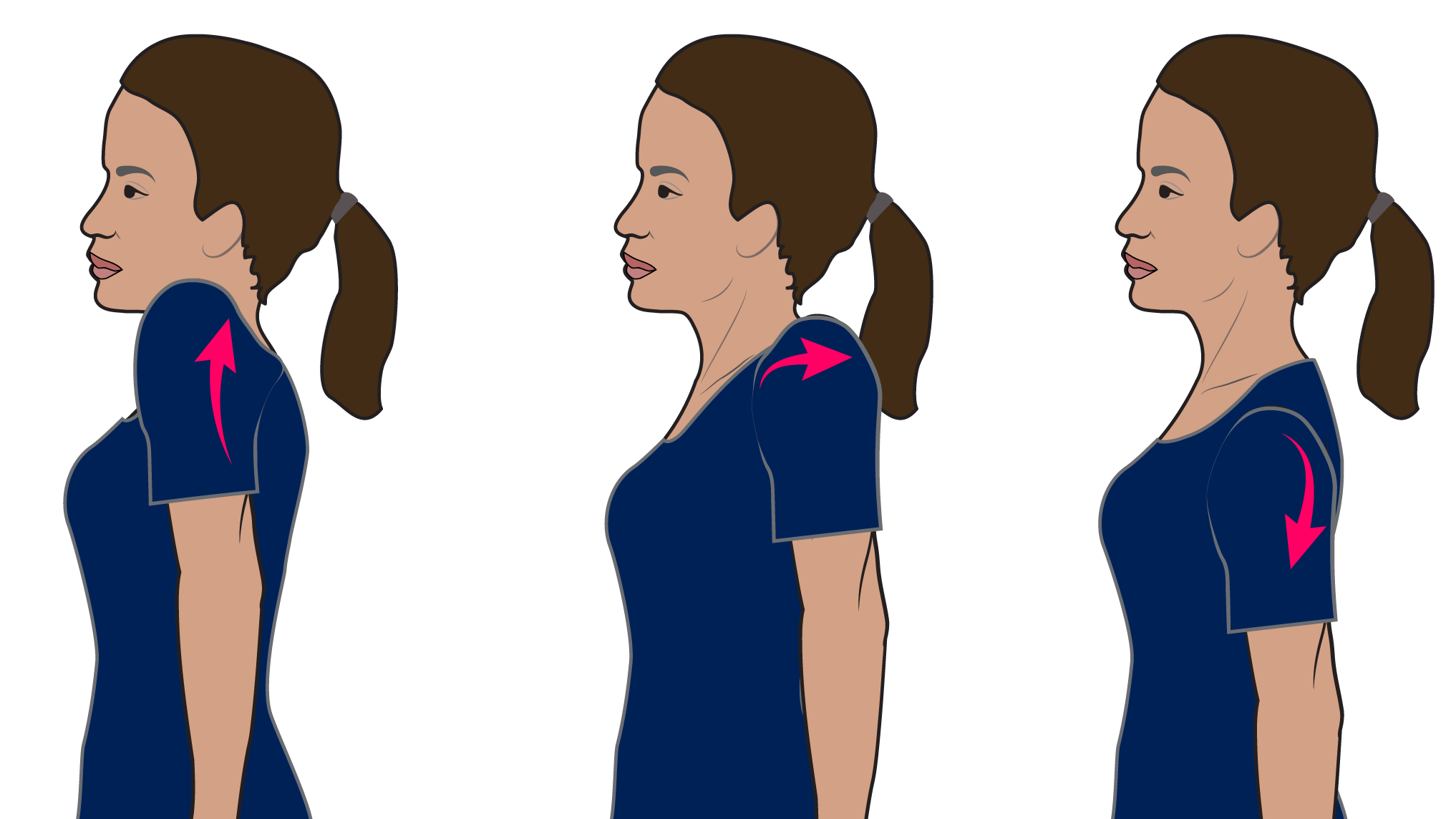 Prehab®️ on X: Pain with Thoracic Outlet Syndrome (TOS) presents anywhere  between the neck, face, occipital region or into the chest & shoulder, with  paresthesia into the upper extremity based on where