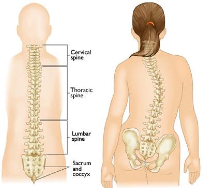 normal spine and scoliosis curves