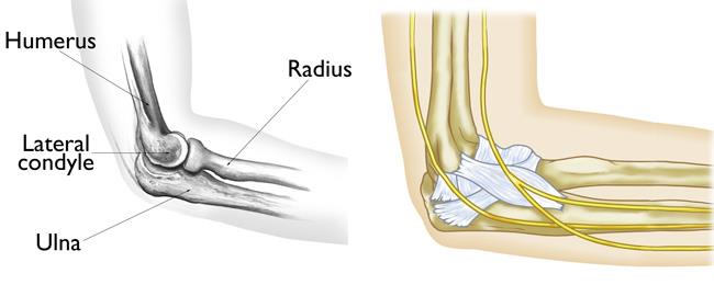 Dislocación De La Rodilla Care Guide Information En Espanol