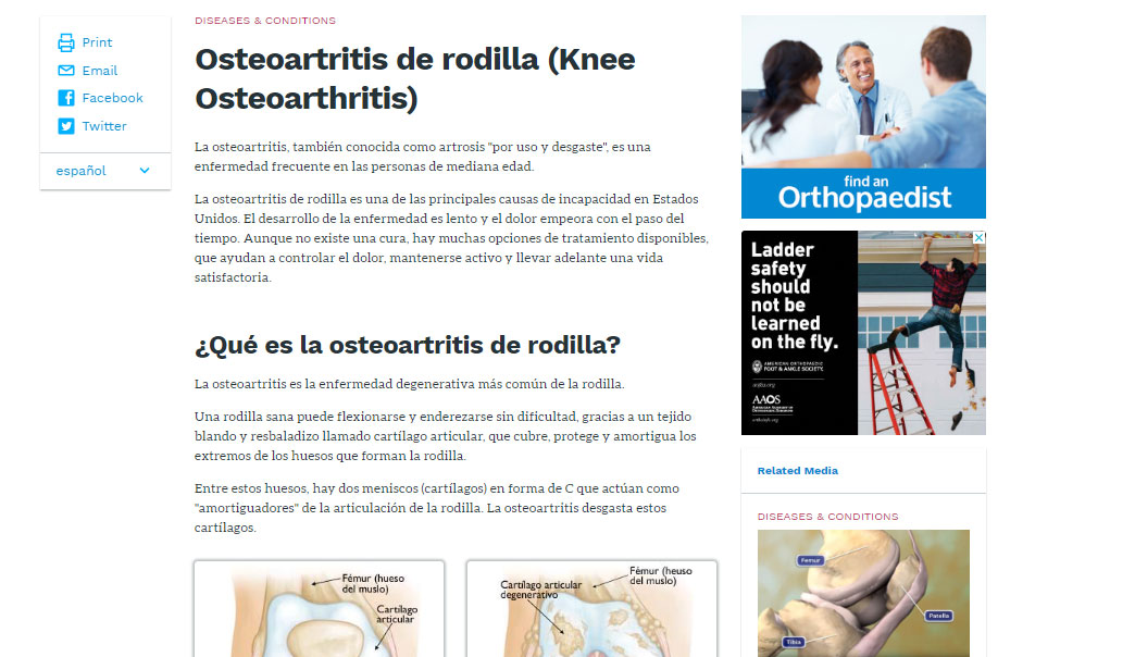 Osteoartritis de rodilla (Knee Osteoarthritis) - OrthoInfo - AAOS