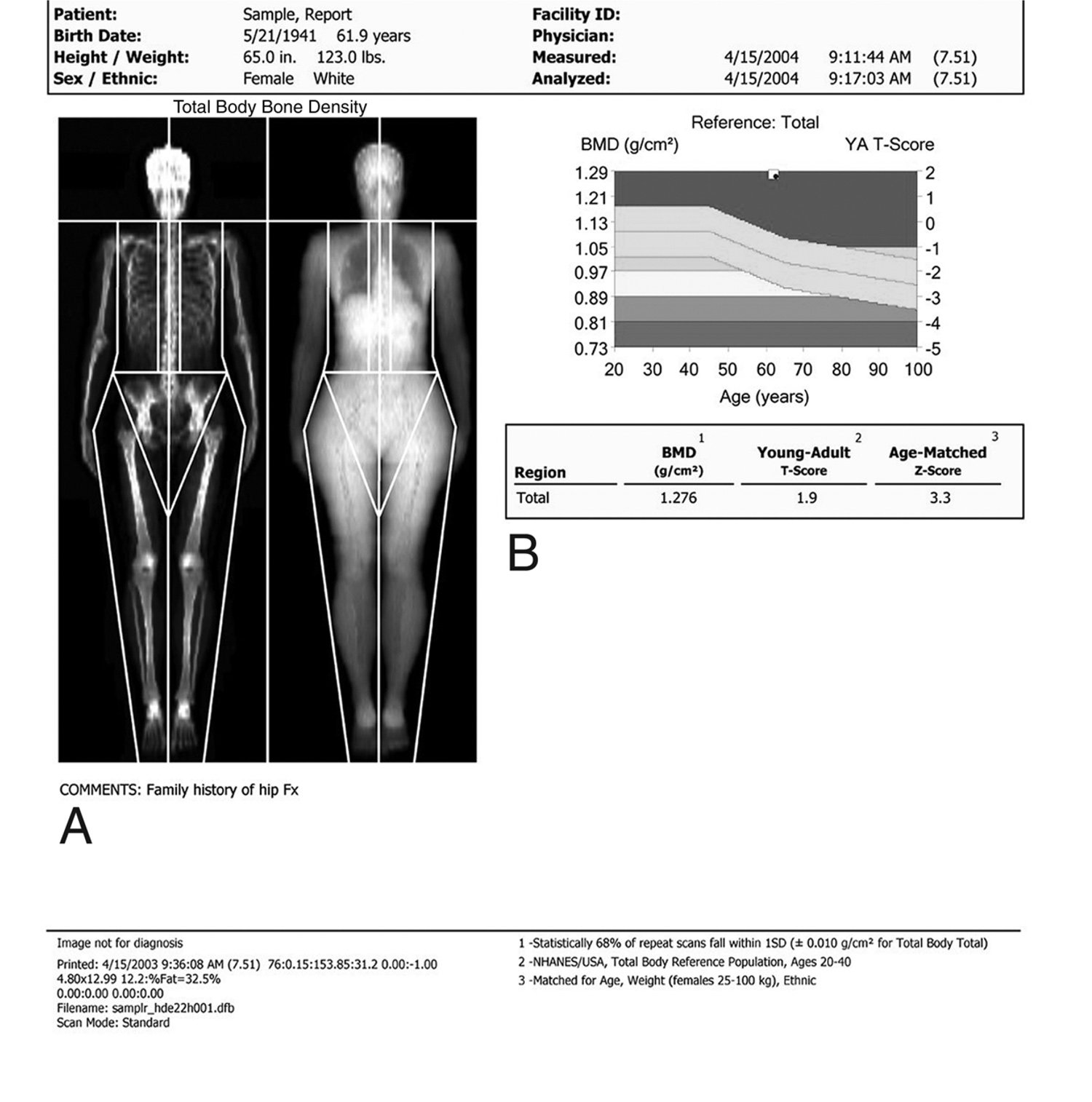 Duel-energy x-ray absorptiometry (DXA) scan