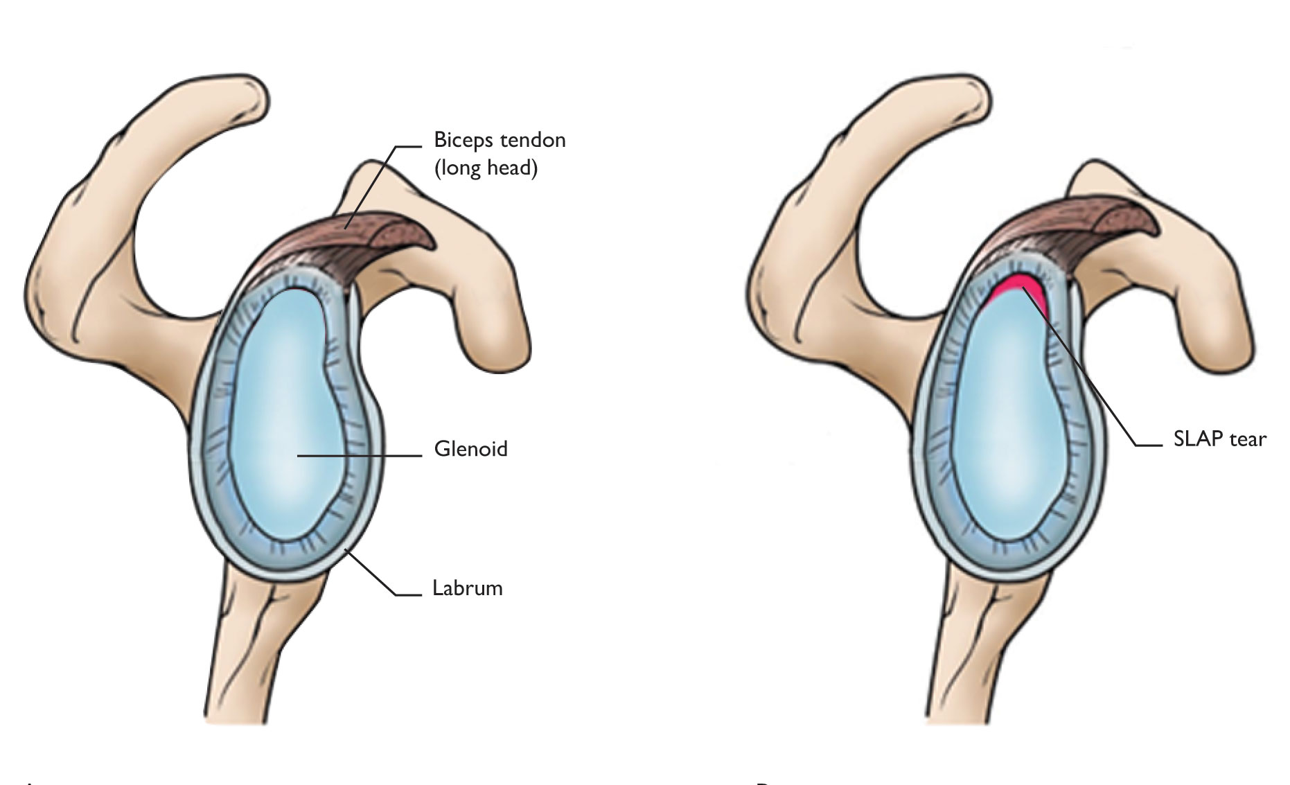 Normal Shoulder Anatomy and SLAP tear