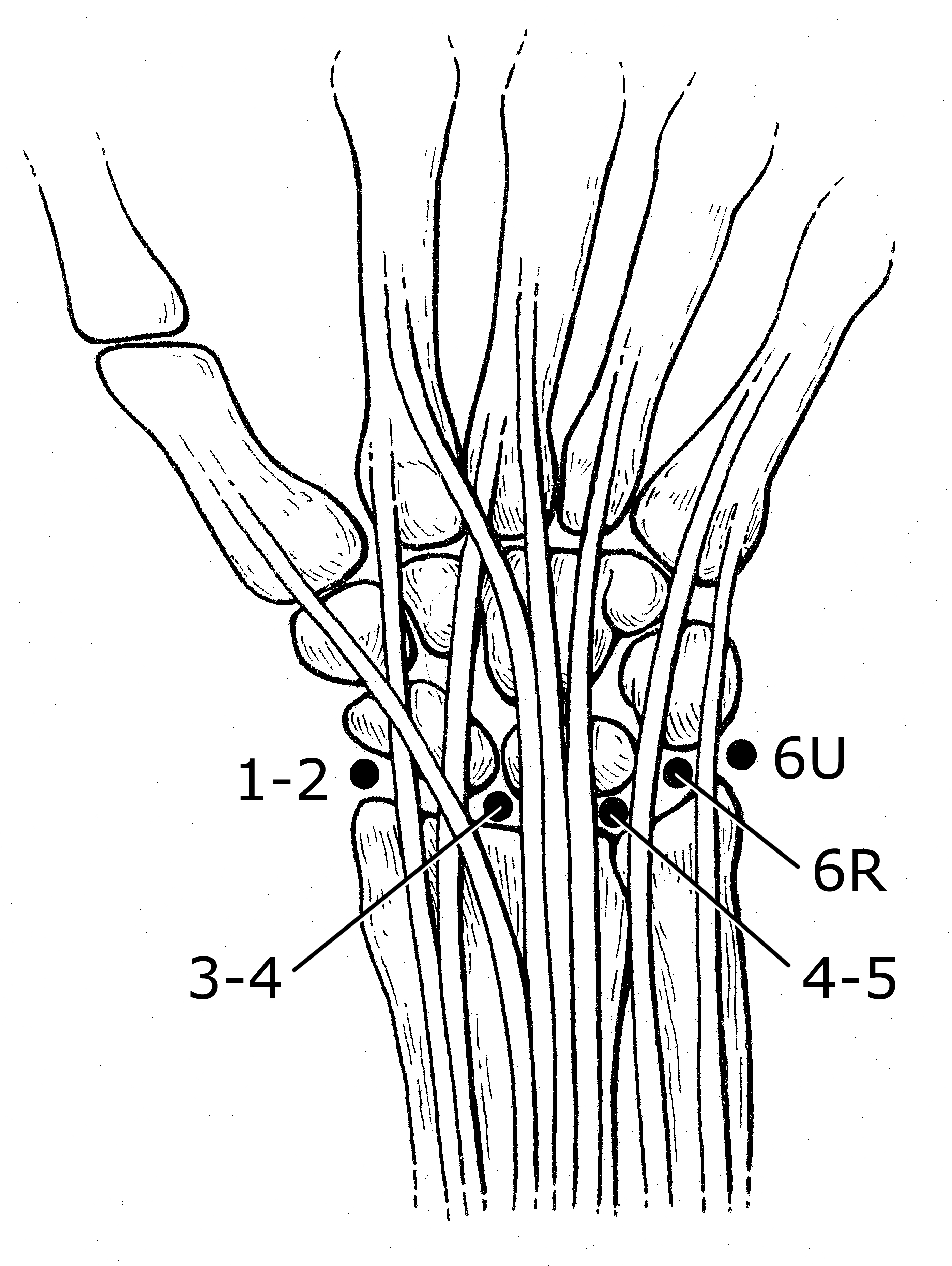 Wrist portals