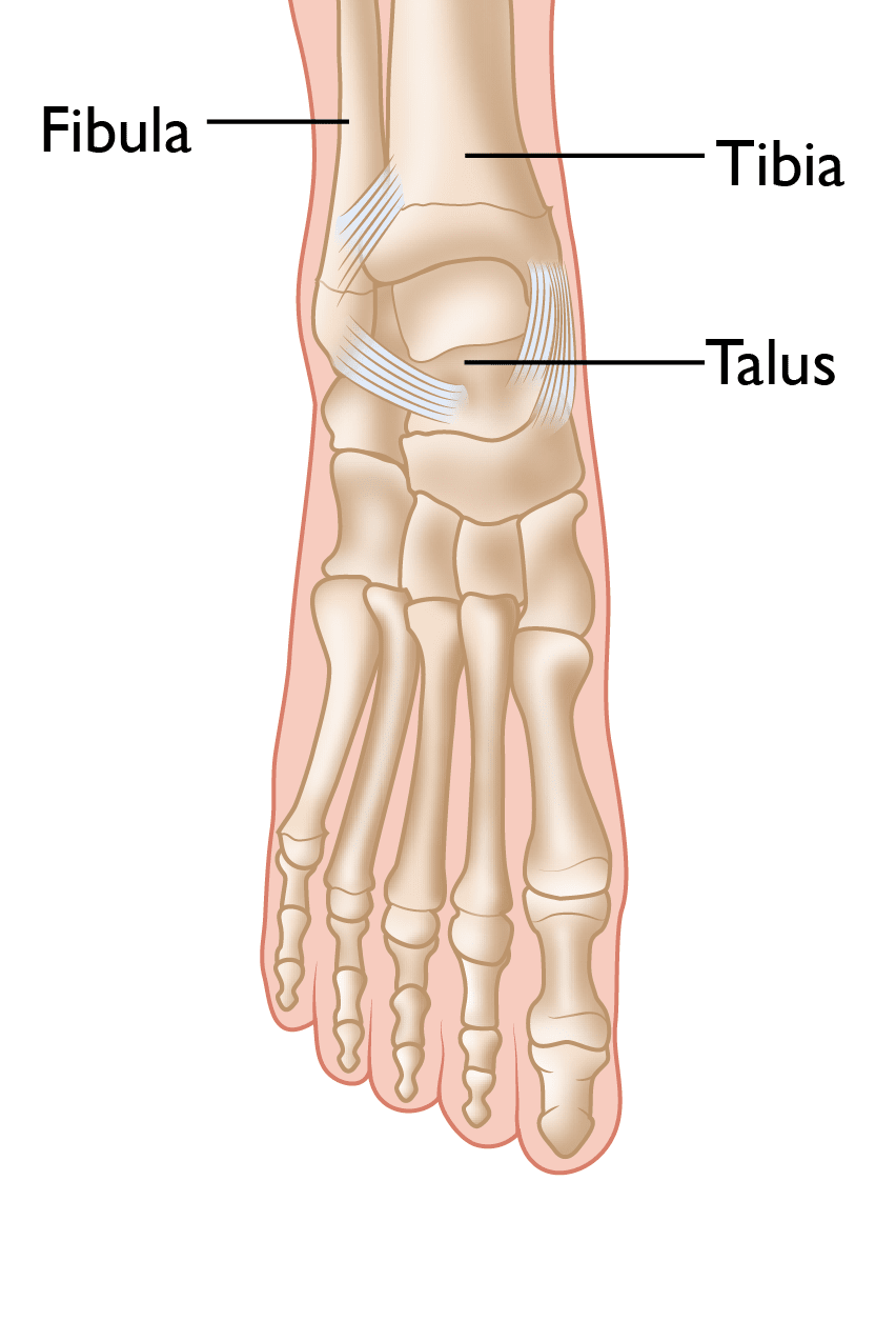 fractured fibula cast