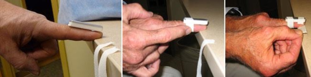 Applying a temporary finger splint