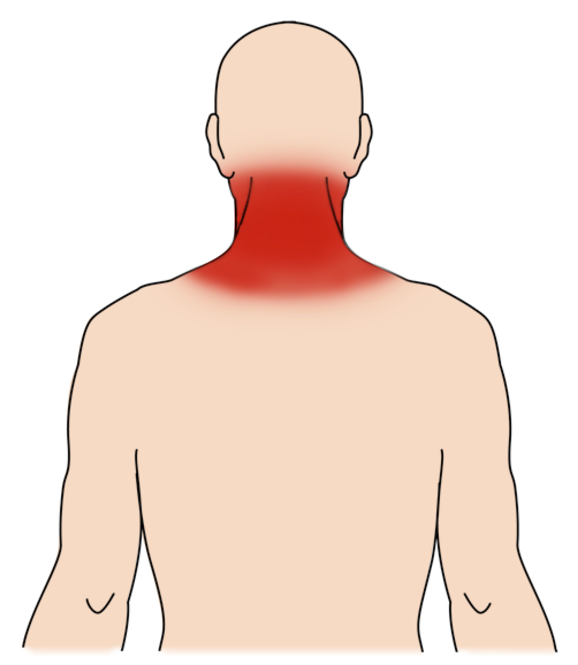 Cervical Placement for Neck Issues Example 