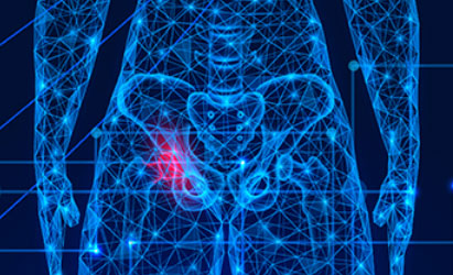 Musculoskeletal Tumor Registry - AAOS