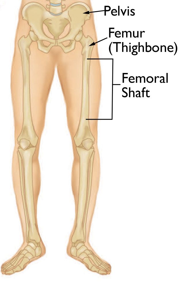 spiral line of femur