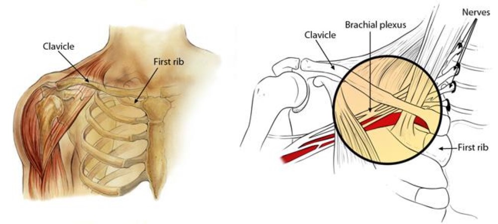 Brachial plexus 