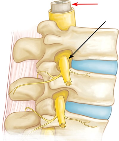 Neurologic-like symptoms and conditions of Cervical Spine