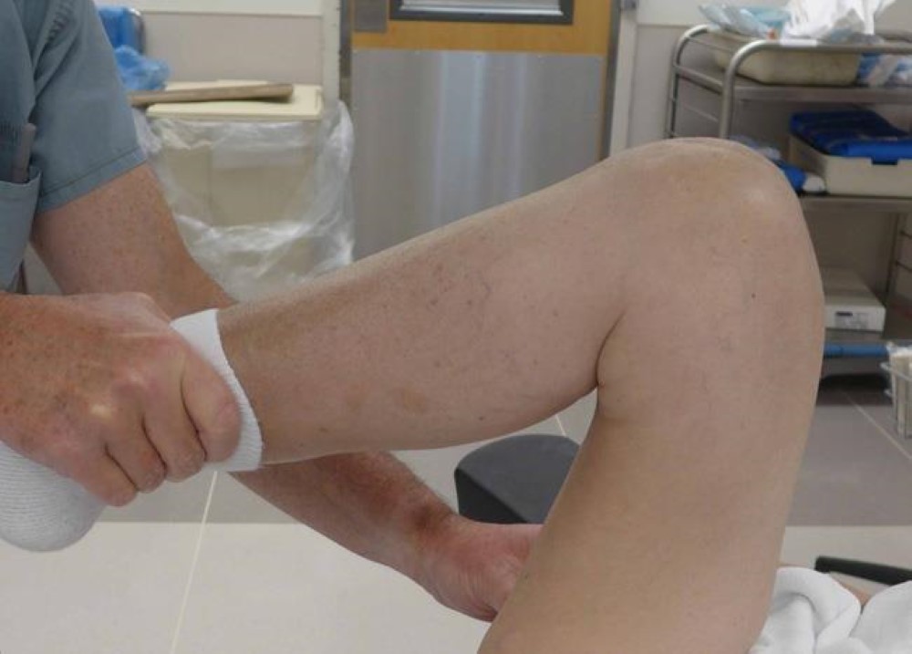 break down scar tissue around knee implant