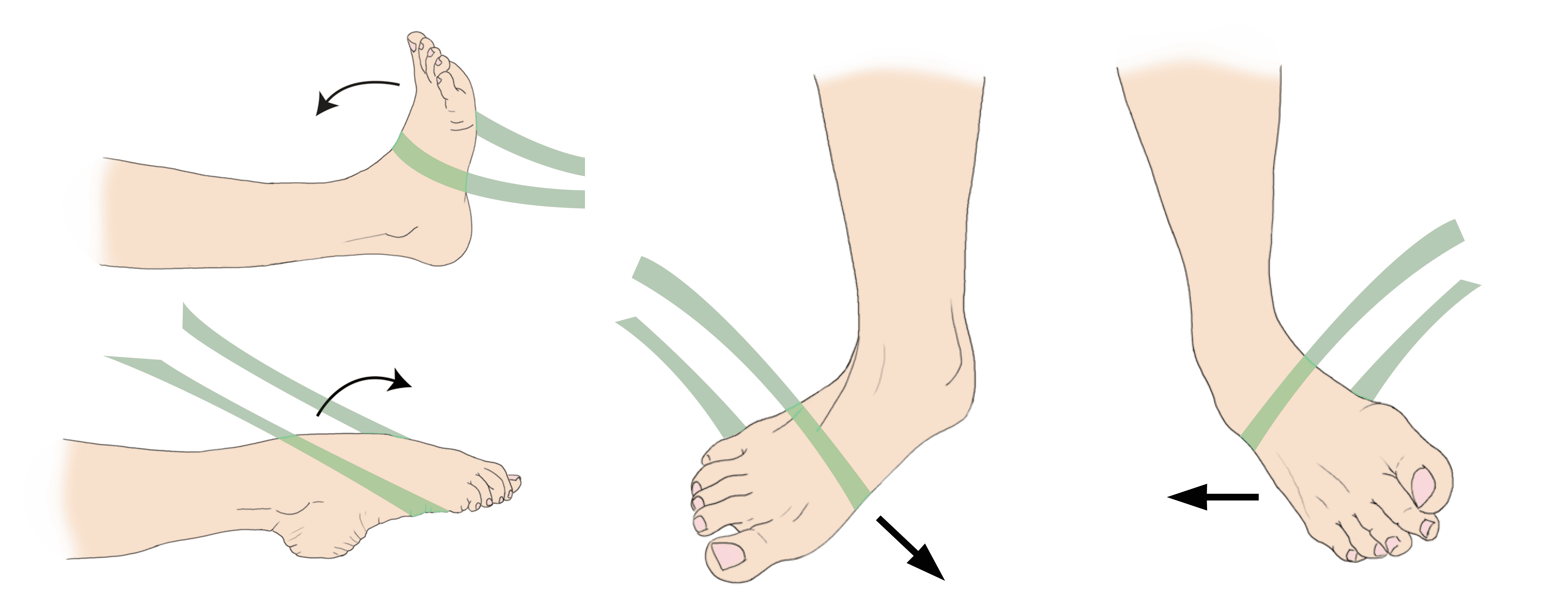 Resistance exercises after ankle sprain