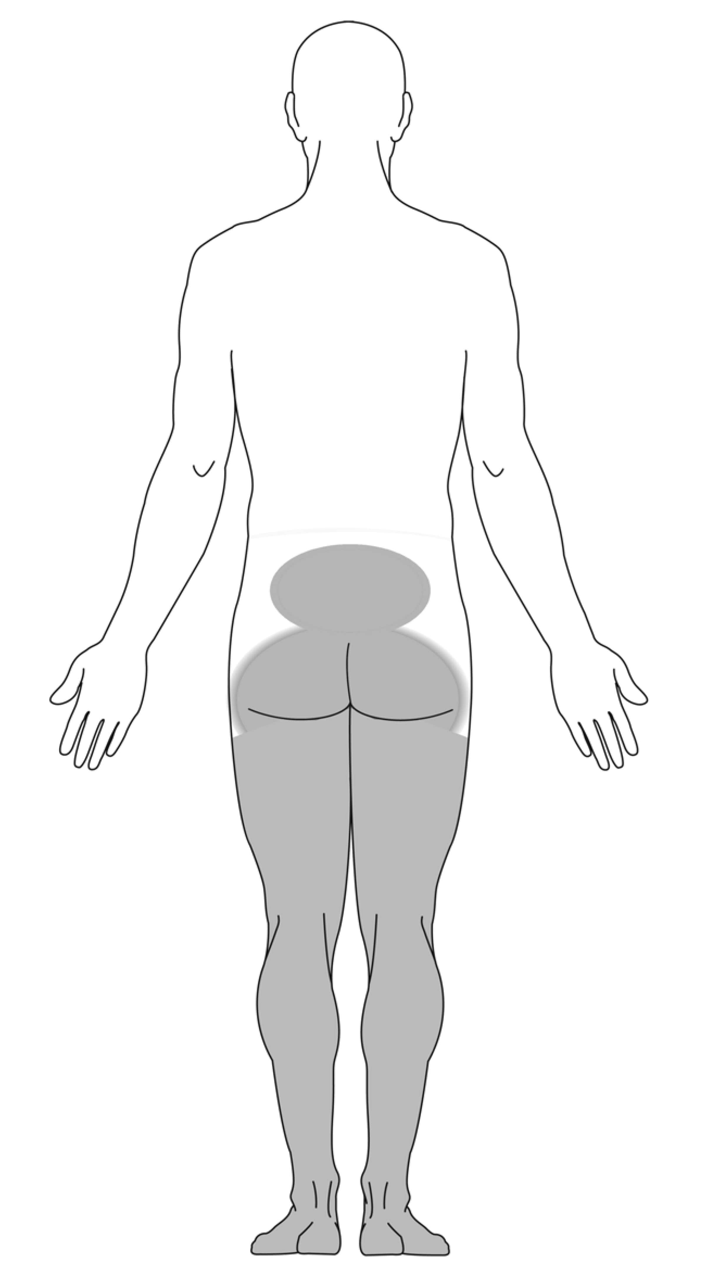 Cauda Equina Syndrome Orthoinfo Aaos 3503