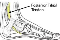 tibialis posterior tendon insertion