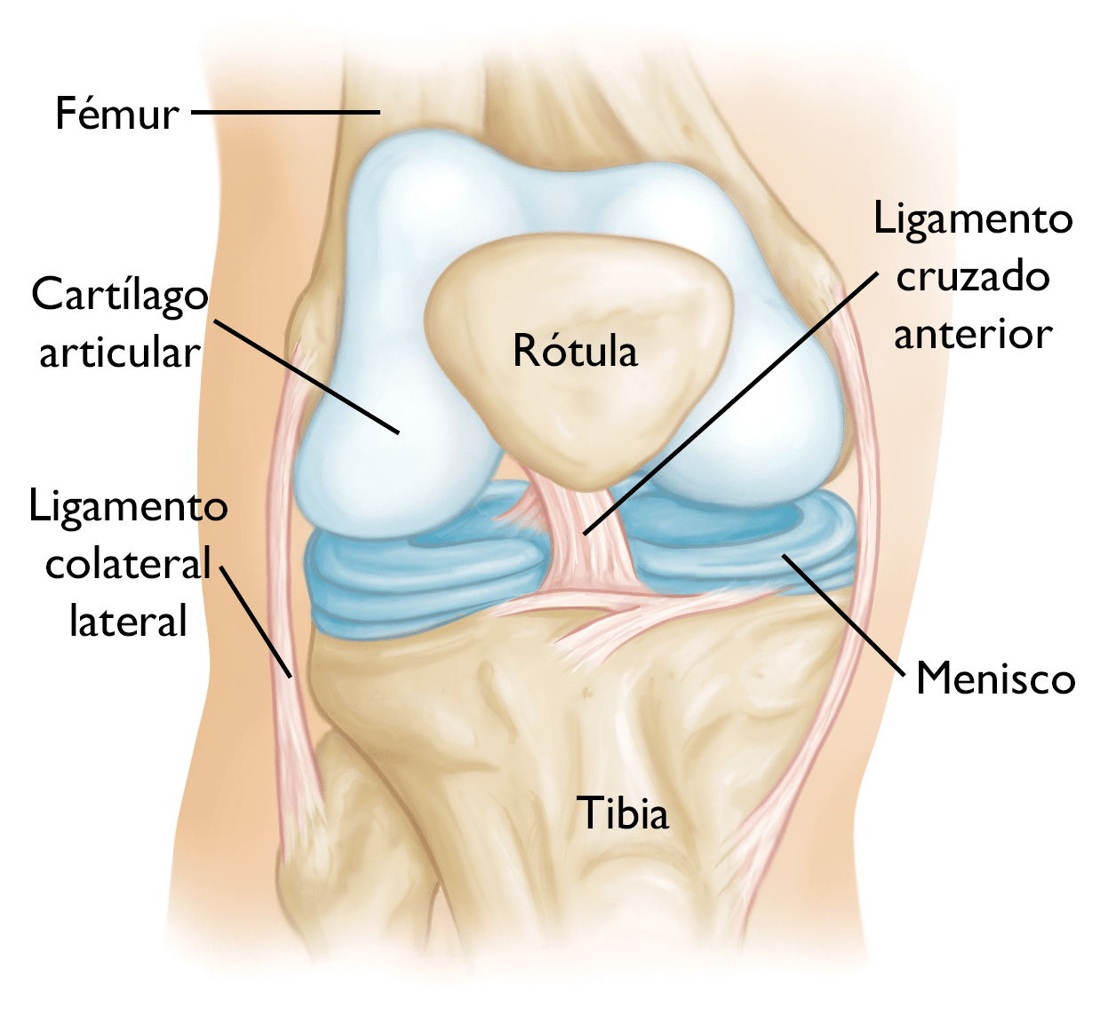 nombre guisante Varios Reemplazo total de rodilla (Total Knee Replacement) - OrthoInfo - AAOS