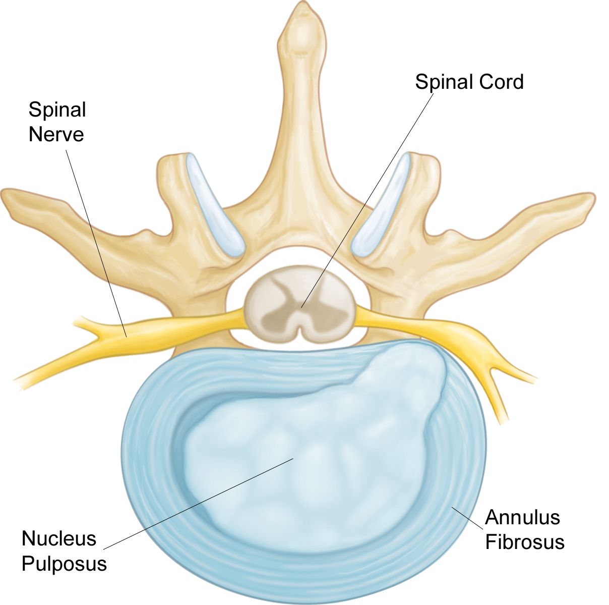 Lumbar Spinal Stenosis - OrthoInfo - AAOS